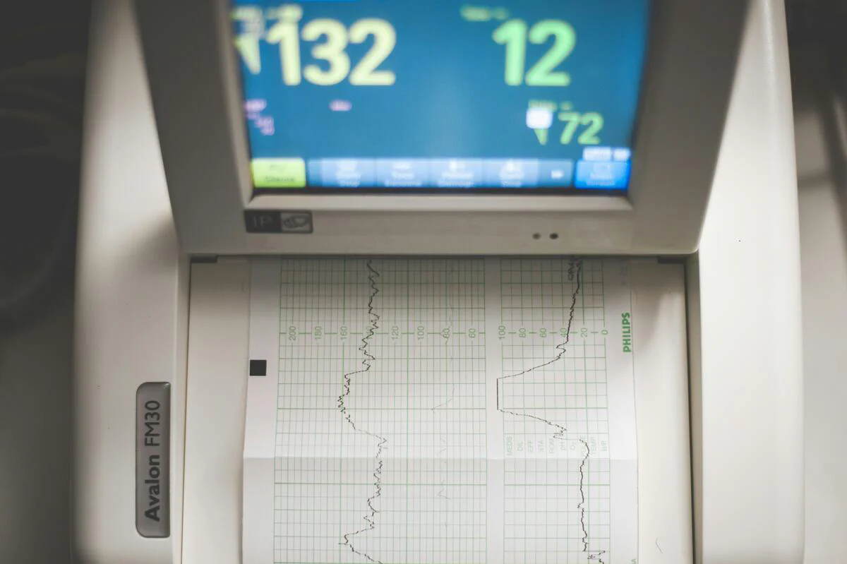 EEG study of Tratak Brainwave visualization during meditation